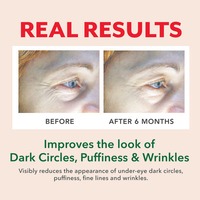 Good Morning Sunshine + Goodnight Eyes Eye Cream Duo Beauty Buster